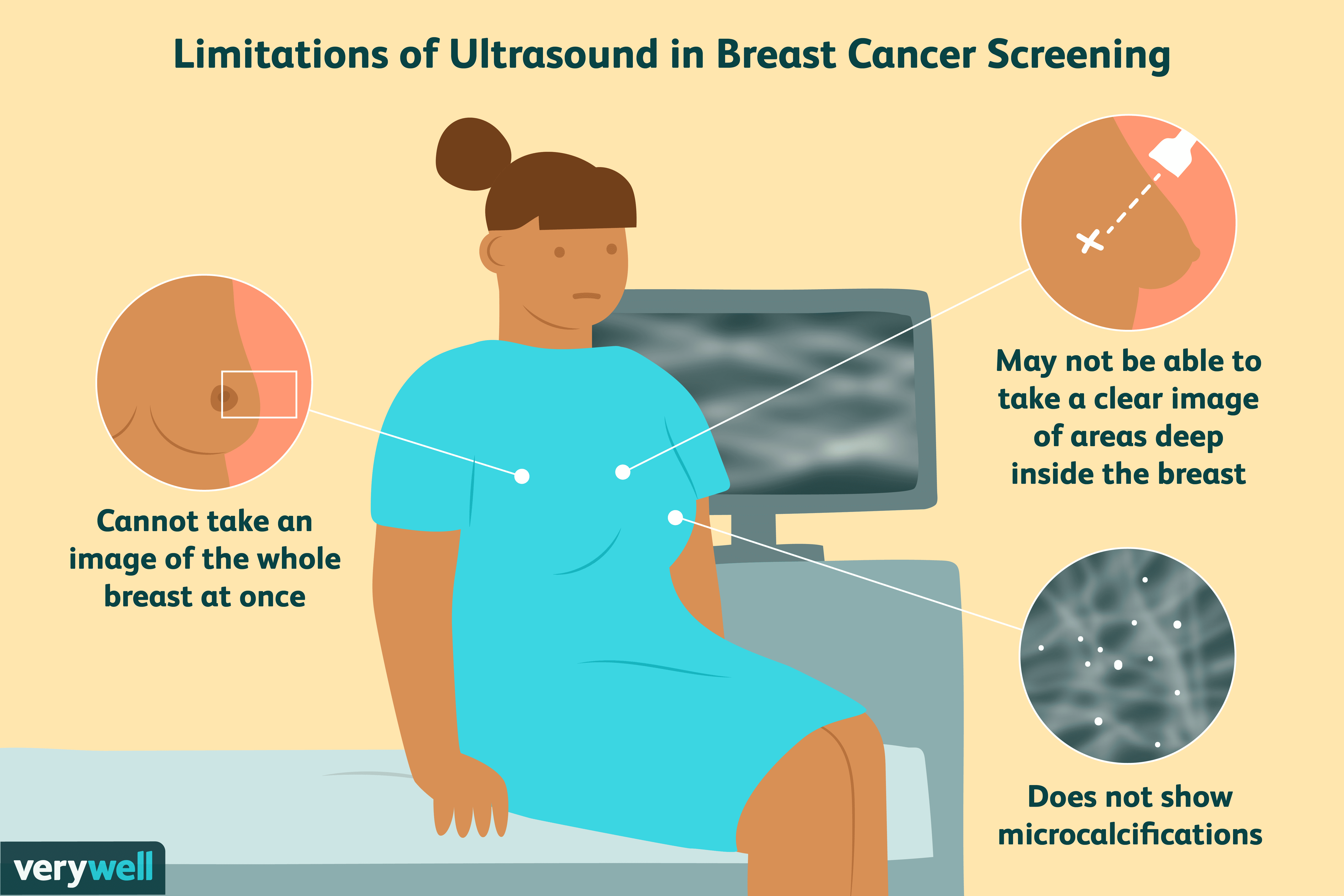 Mamografías anuales versus ultrasonidos anuales 