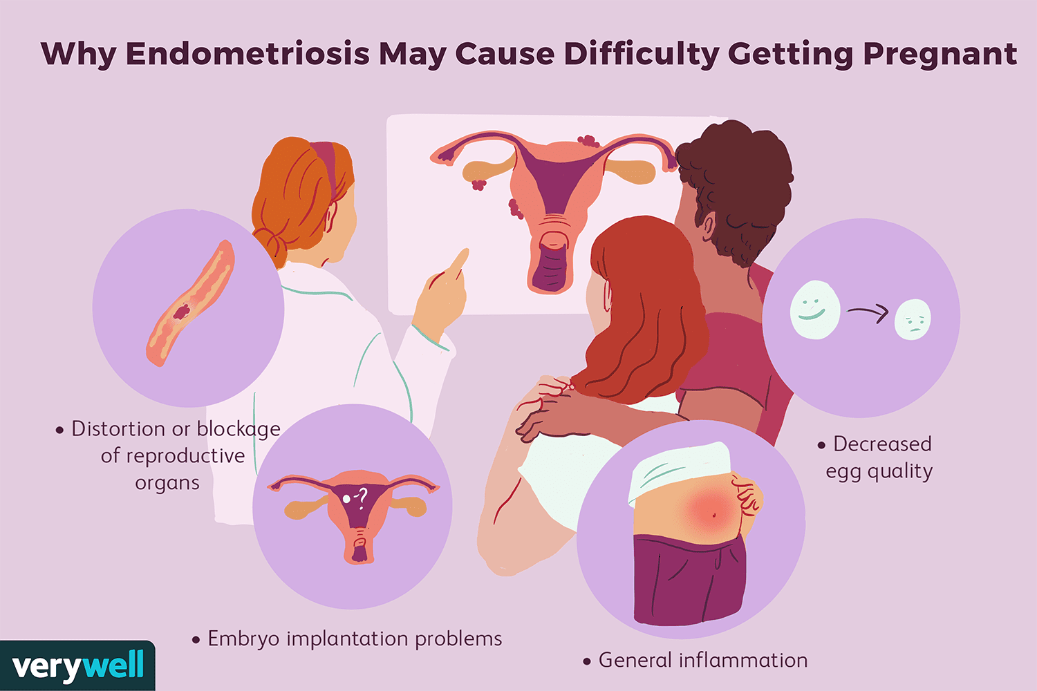 Comment tomber enceinte si vous avez l endométriose 