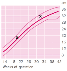 Fostertillväxtdiagram 