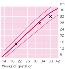 Fostertillväxtdiagram 